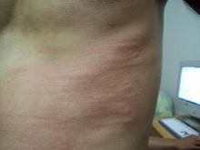 ������Ƥ��