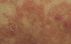 �߿��͸���м��