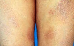 ̦޺���͸���м��