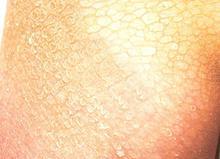 Ѱ�������۲����ٴ�֢״����