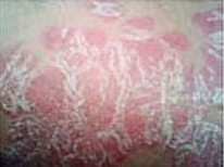 ţƤѢ��֢���Ƶ���Ҫ��