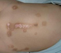 ��ͯţƤѢ���ص�