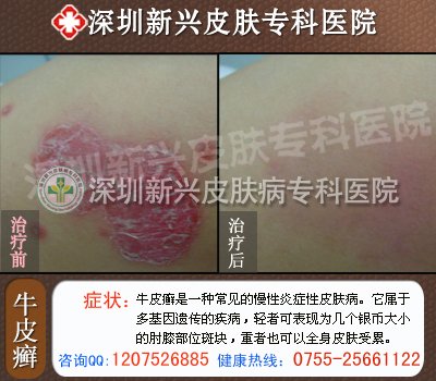 ţƤѢ��ô�ξ�ȥ����ҽԺ