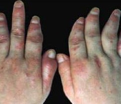 �ؽ���ţƤѢ�����֢״