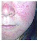 ʪ���֢״����