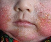 ����������Ƥ�׻���