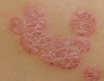 ��ʳ����ţƤѢ