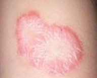 ţƤѢ��������֮��