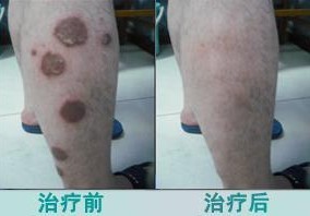 ��������ţƤѢҽԺ