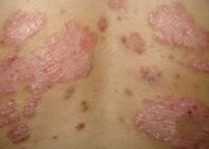 ������ţƤѢҽԺ�ļұȽϺ�