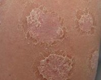 ����ţƤѢҽԺ�ĸ���