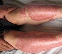 ������õ�ţƤѢҽԺ